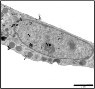 TEM micrographs of U87 cell uptake of Au-5′-TMP NPs after 1 h: AuNPs in various cell compartments (Scale bar 2 μM); N = nucleus; Nu = nucleolus.