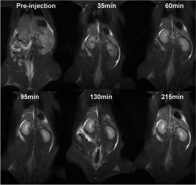 
          In vivo MR coronal images of a rat before and after intravenous injection of (Gd-DO3A)2-BMQX at a dose of 0.1 mmol Gd kg−1 weight. Animal care and handing procedures were in agreement with the guidelines of the Regional Ethics Committee for Animal Experiments.