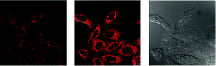 Fluorescence (left), overlaid (middle), and bright-field (right) laser-scanning confocal microscopy images of HeLa cells incubated with complex 15 (5 μM) at 37 °C for 3 h. Taken from ref. 29.