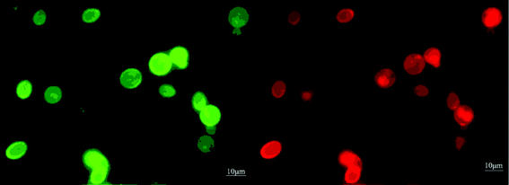 Fluorescence microscope image of co-displayed recombinants. The figure shows the same view under the fluorescence microscope. Right: CALB lipase cells under 495 nm exciting light. Left: TLIM lipase cells under 545 nm exciting light.