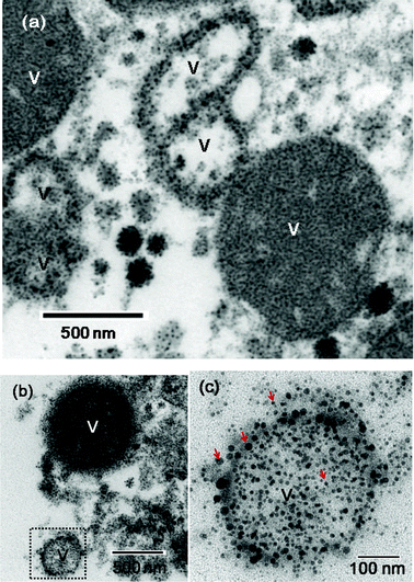 TEM images of fluorescein-PEI coated gadolinium oxide nanoparticles in vesicles (labelled as V) of a liver RES cell. (a) and (b) Filled and likely ruptured vesicles are shown. A dotted square region in (b) is magnified in (c) in which nanoparticles (as examples, four nanoparticles are labelled with arrows) can be seen in a likely ruptured vesicle. Here, many of nanoparticles appear as aggregates.