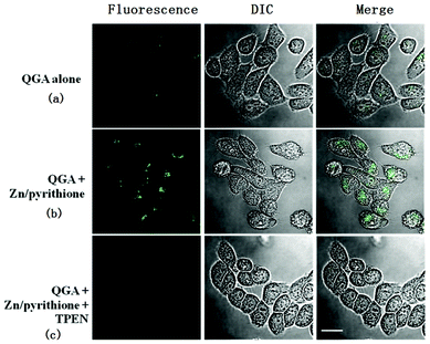 HK-1 cells were incubated with QPA (10 μM) (a), followed by 5 μM Zn(ClO4)2/pyrithione (1 : 1) (b), followed by further incubation with TPEN (20 μM) (c). Green dots represent the fluorescence from zinc ions interacting with the QPA. Scale bar: 20 μm.