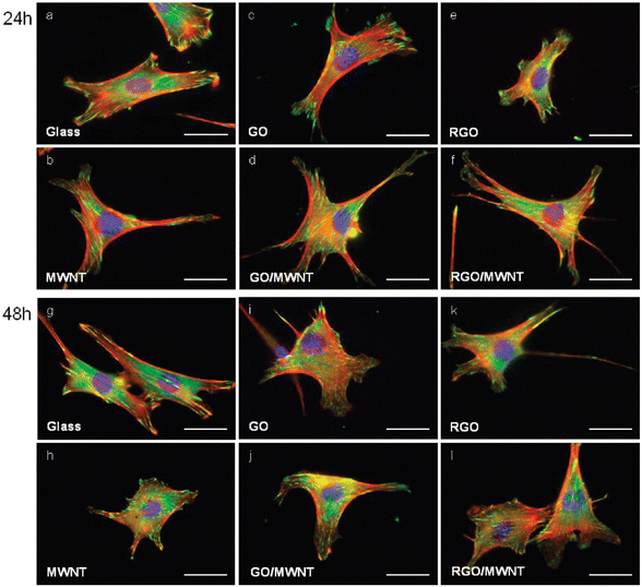 Illustration of NIH-3T3 cells incubated on different substrates for 24 and 48 h. Actin, vinculin and the DAPI-stained nucleus are represent in red, green and blue respectively. Reproduced with permission from ref. 194. Copyright 2010, American Chemical Society.