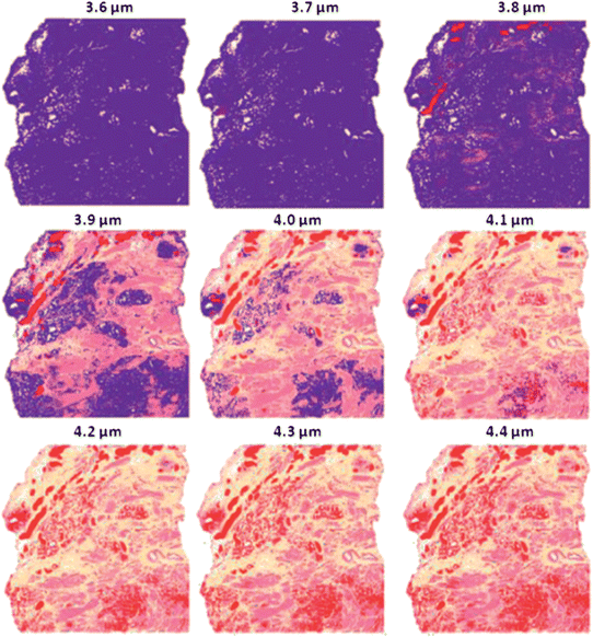 False colour classification images of the 5 class histological model for prostate tissue. Classifier trained on a database of transflection simulated spectra of 4 μm thickness.