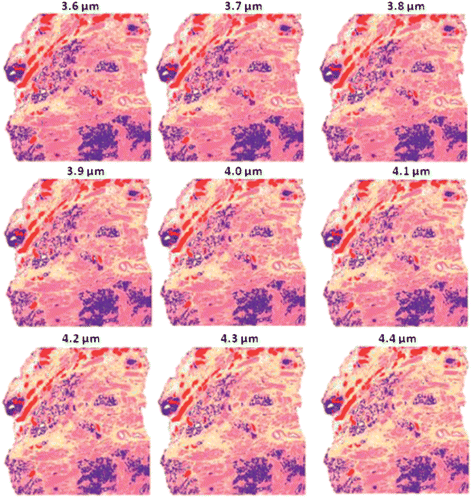 False colour classification images of the 5 class histological model for prostate tissue. Classifier trained on a database of transflection simulated spectra of 4 μm thickness using a second derivative.