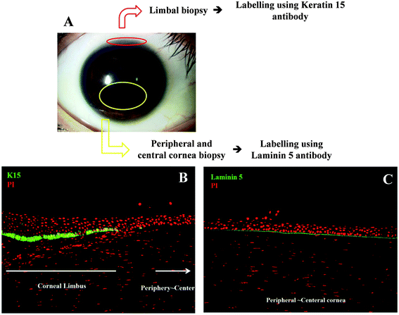 Immunofluorescent staining of corneal cell biopsies. Corneas were obtained from the US donor bank and regions isolated for cell staining (A) and identification (stained with propidium iodide to identify all cells and positive cells labelled green in B and C). K15+ cells in (B) are putative stem cells. In (C), Laminin 5+ (LAM5+) cells are putative transit-amplifying cells and Laminin 5− (LAM5−) cells are putative terminally-differentiated cells.