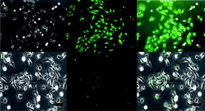 Live-cell imaging of MDA-MB-231 cells treated with BODIPY dye 1 before (A) and after (B) incubation with BODIPY dye 1 with CN− ion. The left panel represents the bright-field transmission images, the center panel represents the fluorescence and the right panel represents respective bright-field and overlay images. Scale 50 μm.