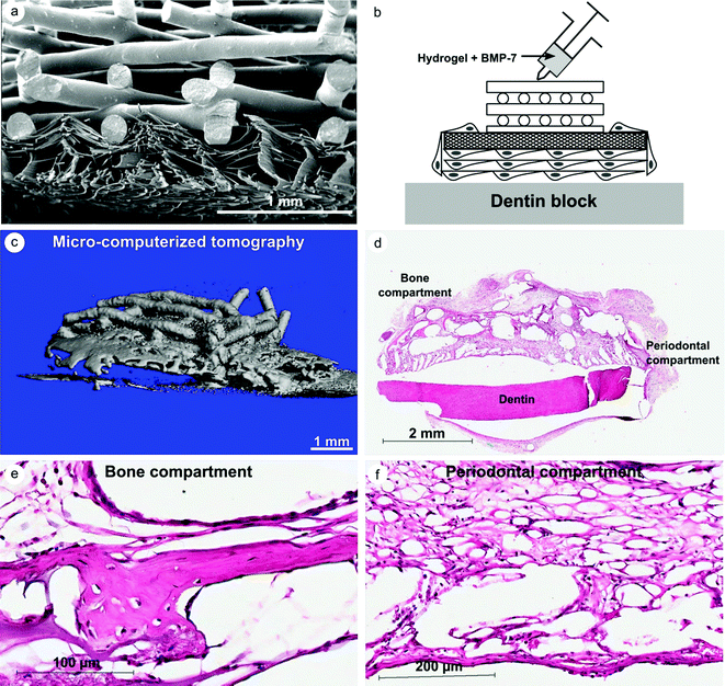 Biphasic scaffold composed of a FDM and a melt electrospun scaffold for periodontal regeneration. (A) Morphology of the cross-section of the biphasic scaffold (SEM), (B) description of the strategy utilized in our proof of principle study, (C) 3D reconstruction of the mineralization construct 8 weeks post-implantation, and (D)–(F) histological analysis of the bone and periodontal compartment. Courtesy of S. Ivanovski, S. Hamlet and C. Vaquette from unpublished data.