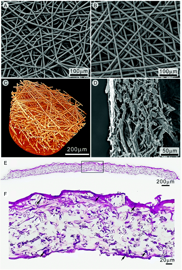 Scanning electron microscopy of PCL scaffolds produced via (A) static conditions and (B) direct writing mode. Three dimensional visualization of a melt electrospun written scaffold using μCT is shown in (C). Fibroblast infiltration of the electrospun written scaffold after 14 days was assessed via SEM (D). Histological sections of a fibroblast seeded scaffold (E) show cells present within the scaffold, in (F). The white arrows in (F) indicate PCL fibers while the black arrows show fibroblast nuclei. Figures are reproduced from ref. 56 with permission.