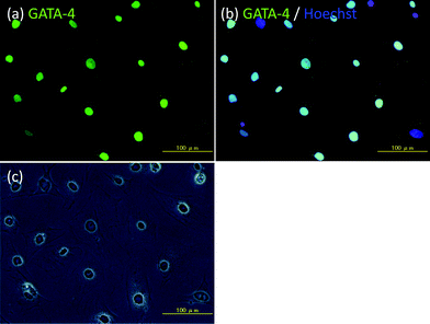 Immunohistochemical examination of Sertoli cells isolated from the testis of male BALB/c mice. (a) GATA-4 (green fluorescence), (b) GATA-4 (green fluorescence) and Hoechst 33258 (blue fluorescence), and (c) phase contrast microscopic image. Scale bar: 100 μm.