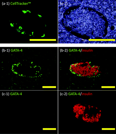 Histochemical analyses of Sertoli cells and islets in liver veins. (a) Sertoli cell-immobilized islets in the mouse liver: (a-1) CellTracker™ (green fluorescence) and (a-2) phase contrast microscopic image. (b) Sertoli cell-immobilized islets in the mouse liver: (b-1) GATA-4 (green fluorescence) and (b-2) Merged images of GATA-4 (green fluorescence) and insulin (red fluorescence). (c) Naïve islets in the mouse liver: (c-1) GATA-4 (green fluorescence) and (c-2) merged images of GATA-4 (green fluorescence) and insulin (red fluorescence). Scale bar: 100 μm.