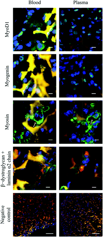 Immunofluorescence micrographs demonstrating expression of MyoD1 (green), myogenin (green), myosin (green), β-dystroglycan (green), and laminin α2 chain (red) in myoblasts cultured for 14 days on blood and plasma cryogels. Sections were counterstained with DAPI (nuclear dye, blue). All cryogels were autofluorescent at wavelengths of around 488 nm (green) and 546 nm (red), which gave rise to an orange-like colour when merged. Arrows indicate cells with several nuclei. Negative controls, presented at a lower magnification to illustrate cell distribution, were incubated with the secondary antibody only. Scale bars on rows 1–4 equal 10 μm, and 100 μm on row 5 (negative control).