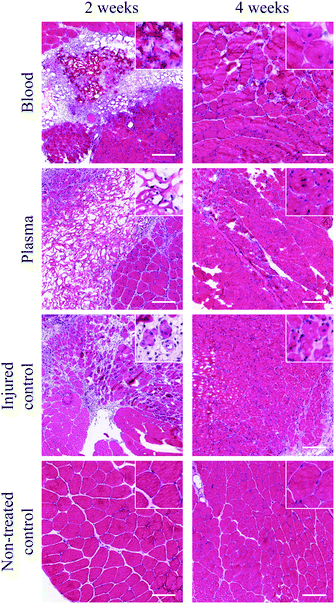 Histology (stained with haematoxylin and eosin) of transplanted scaffolds into mouse quadriceps muscles. The upper right corner illustrates scaffold area/tissue at a 10× higher magnification. Scale bars equal 50 μm.