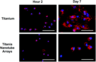 Representative fluorescence microscope images of adhered monocytes, macrophages, neutrophils and foreign body giant cells (3 or more nuclei) stained with DAPI (nuclei) and rhodamine-conjugated phalloidin (actin, cytoskeleton) on titania nanotube arrays and biomedical grade titanium after 2 hours and 2 and 7 day of incubation in human whole blood lysate. The images indicate a decrease in immune cell adhesion, activation and fusion on titania nanotube arrays. The scale bar represents 50 μm.