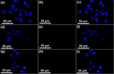 Confocal laser scanning microscopy (CLSM) of HeLa cells incubated with DOX-UCNPs@mSiO2-PEG/FA (a–c), DOX-UCNPs@mSiO2-PEG (d–f) and DOX-UCNPs@mSiO2-PEG/FA + free FA (g–i) for 1 h at 37 °C. Each series can be classified to the nuclei of cells (being dyed in blue by Hoechst 33342 for visualization), the samples, and the merging of the two channels of both above, respectively.