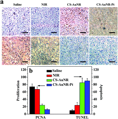 (a) TUNEL (up) and PCNA (bottom) stain of H22 tumor tissue slips that received different treatments as indicated. Scale bar = 25 μm. (b) The apoptosis and proliferation index calculated as the number of positive hepatocytic nuclei divided by the total number of hepatocytic nuclei in at least five randomly selected fields.