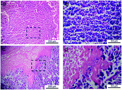 H&E-stained histological sections of tumors captured from S-180 bearing KM mice at the seventh day after subcutaneous injection of saline (a) and DOX-loading gel formulation (c). (b) and (d) are magnified images of the indicated regions in (a) and (c), respectively. Serious necrosis of tumor tissue was observed in the upper left of (c) and (d).