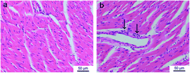 H&E-stained histological sections of heart tissues isolated at the seventh day after subcutaneous injection of saline (a) and DOX-loading gel formulation (b) in S180-bearing KM mice. The increment of interval between myocardial cells reflects the edema of tissue. The arrows denote the inflammatory cells (macrophage).