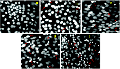 Apoptosis study of HeLa cells treated with (a) control (PBS), (b) 5 μg ml−1, (c) 10 μg ml−1, (d) 15 μg ml−1, and (e) 25 μg ml−1 DOX loaded FA-HSNPs. Arrows in the figures indicate apoptotic nuclei.