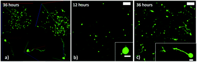 (a) ESMNs exhibit robust axonal outgrowth in three-dimensions when encapsulated in the engineered PEG hydrogel (scale bars 100 and 10 μm within inset). (b) Representative image of ESMNs 12 hours post-encapsulation. Small axonal buds are seen in the inset image. (c) Representative image of ESMNs 36 hours post-encapsulation.