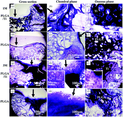 Non-decalcified histological sections of (a–c, g–i) PLGA/Ti group and (d–f, j–l) PLGA group at 1 month (a–f) and 3 months (g–l) after operation. The photos of (b, e, h, k) were the local magnification of chondral phase (200×) in the photos of (a, d, g, j), respectively, and the photos of (c, f, i, l) were the local magnification of osseous phase (100×) in the photos of (a, d, g, j), respectively. Insertions were enlarged views of the cartilage-like area and subchondral bone area. Stain: Toluidine-blue. NT: Newly formed tissue, CT: Cartilage-like tissue, B: bone. The black arrow pointed to the repair interface of cartilage, arrow 1 pointed to the chondrocytes and arrow 2 pointed to the osteocytes.