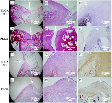 Decalcified histological sections of (a–c, g–i) the PLGA/Ti group and (d–f, j–l) the PLGA group at 3 months after operation at magnifications of (a, d, g, j) 40× and (b, c, e, f, h, i, k, l) 200×. The defects were stained with HE (a, b, d, e), toluidine-blue (c, f), safranin-O (g, h, j, k) and immunohistochemically stained with collagen type II (i, l). The arrows pointed to the repair interface of cartilage.