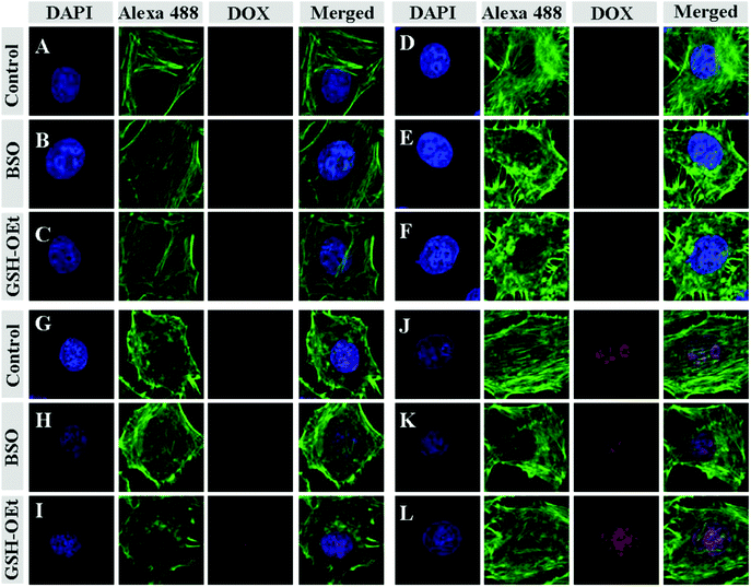 CLSM microimages of HeLa cells incubated with SAD (A, B and C), CAD (D, E and F), DAD (G, H and I) and DOX-loaded nanogels (J, K and L): cells without pretreatment (A, D, G and J); cells pretreated with 0.5 mM BSO (B, E, H and K); cells pretreated with 10.0 mM GSH-OEt (C, F, I and L). For each panel, the microimages from left to right show cellular nuclei stained by DAPI (blue), F-actin stained by Alexa 488 (green), DOX fluorescence in cells (red) and the overlays of the three microimages.