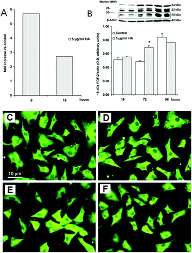 FGF-2 up-regulation in CVECs exposed to HA nanocrystals for 4 days. (A) The RT-PCR analysis of FGF-2 mRNA expression. CVECs were exposed to HA nanocrystals (5 μg mL−1) for 6 and 18 h. Data are reported as fold increases in the FGF-2 expression (corrected for actin transcription) over the control condition (0.1% serum). (B) The FGF-2 protein expression. Cell lysates were separated by 15% SDS-PAGE and FGF-2 expression was detected by Western blotting. Data of the 18 kDa isoform of FGF-2 are reported as the optical density of the ratio between the target protein and β-actin. (C) The control sample. (D–F) The expression and localization of the angiogenic factor FGF-2 were measured in CVECs grown for 4 days on glass coverslips by immunofluorescence. The concentrations of HA nanocrystals were 2 μg mL−1, 5 μg mL−1 and 10 μg mL−1, respectively.42