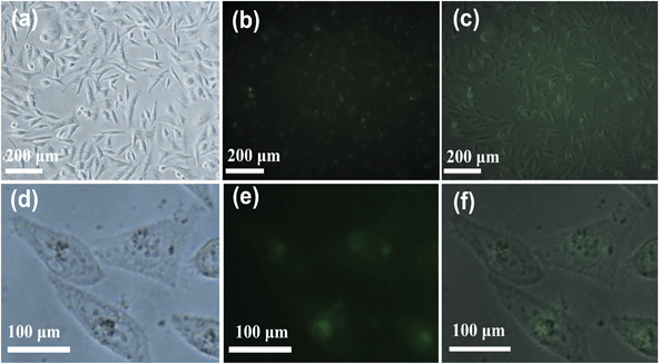 Images of human gastric carcinoma cells (SGC-7901) treated with the fluorescein-loaded HAPUN/MNs nanocomposite obtained using an Olympus IX71 optical microscope.