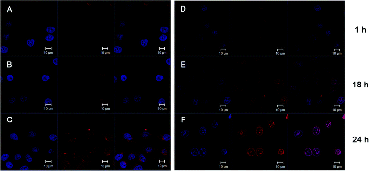 CLSM images of HeLa cells incubated with F-30-20-DOX7 micelles for 1 h (A), 18 h (B) and 24 h (C), and with free DOX for 1 h (D), 18 h (E) and 24 h (F). For each panel, images from left to right show the cells with nuclear staining by Hoechst 33258, with DOX fluorescence and overlays of both images.