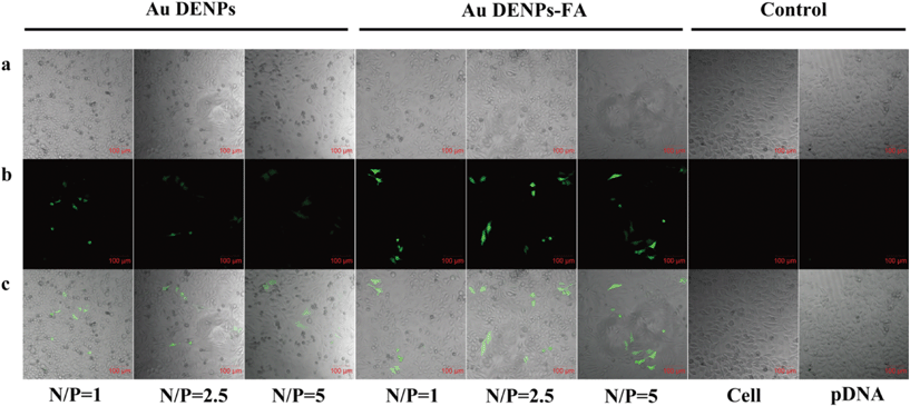 Confocal microscopic images (100×) of EGFP gene expression in HeLa cells. Images were taken 24 h after transfection under similar instrumental conditions. (a) Bright field image; (b) green fluorescence image; and (c) merged bright field image and green fluorescence image.