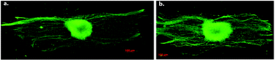 Effect of fiber density on the number of neurites produced by DRG cells cultured on a. low density, and b. high density aligned electrospun PLLA scaffolds for five days. Immunohistochemistry is performed for neurofilament. Reproduced with permission from ref. 47.