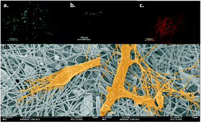 Neural differentiation of hESCs on electrospun PU scaffolds. Differentiated cells express β-III tubulin (a), MAP2ab (b) and TH (c). (d) SEM micrographs of differentiated cells are demonstrated. Reprinted with permission from ref. 24.