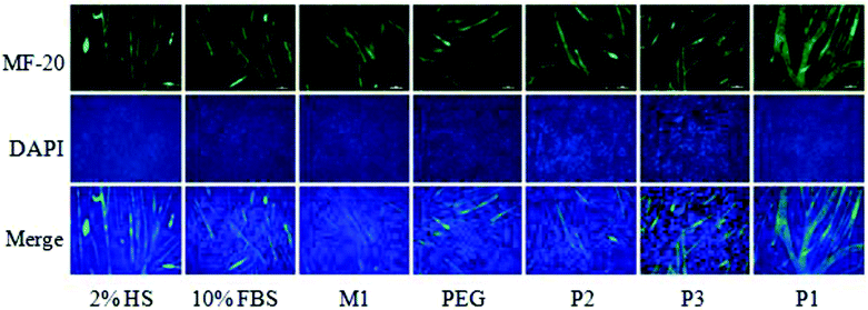 Differentiation of C2C12-myoblast to myotube. Fluorescence images of cells treated with 2% HS, 10% FBS, M1, PEG, P2, P3 and P1 (100 μM) for 4 days. The myotubes and nuclei were stained with MF20 (green) and DAPI (blue), respectively. Both green and blue images were merged to quantify length, width and fusion index. Scale bar = 50 μm.