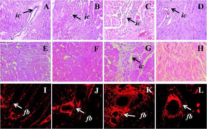 Upper panel shows haematoxylin and eosin staining of heart (×20) for inflammatory cell infiltration (arrow head) in C (A), CA (B), H (C) and HA (D) rats. Middle panel shows higher magnification (40×) of heart section of C (E), CA (F), H (G) and HA (H) rats; lower panel shows picrosirius red staining of perivascular and interstitial collagen deposition in C (I), CA (J), H (K), and HA (L) rats. ic-Inflammatory cells, fb-fibrosis; C, corn starch-rich diet-fed rats; CA, corn starch-rich diet-fed rats treated with l-arginine; H, high carbohydrate, high fat diet-fed rats; HA, high carbohydrate, high fat diet-fed rats treated with l-arginine.