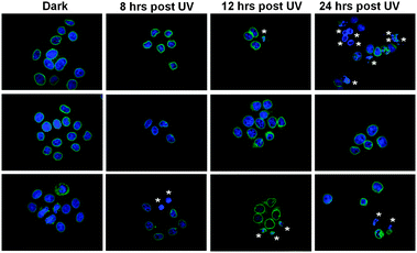 HeLa cells were exposed to UV light for 3 minutes and then fixed at different time points. This helps elucidate the post exposure time when any cellular alterations are most visible and serves as a positive control to which later experiments are compared. Maximum DNA condensation (*) is evident at 24 hours post UV exposure, though cellular response is heterogeneous. (Blue = Hoechst 33342/DNA; Green = Emerin).