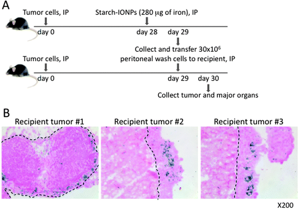 CD45+ peritoneal phagocytes carry IONPs specifically to tumors. (A) Diagram of experimental strategy, IONPs were injected IP 28 days post tumor cell inoculation. 18 hours later, peritoneal wash cells were collected and 30 × 106 unsorted cells were injected IP into tumor-bearing recipient mice. (B) Prussian blue staining of tumor sections to test the homing of IONP-loaded peritoneal cells into tumor. Iron-positive cells were found in recipient tumors. Dashed lines indicate the boundary between normal tissues (pancreas in the left and muscles in the center and right) and tumor burden. Data are representative of 3 independent experiments using 4 mice each time.