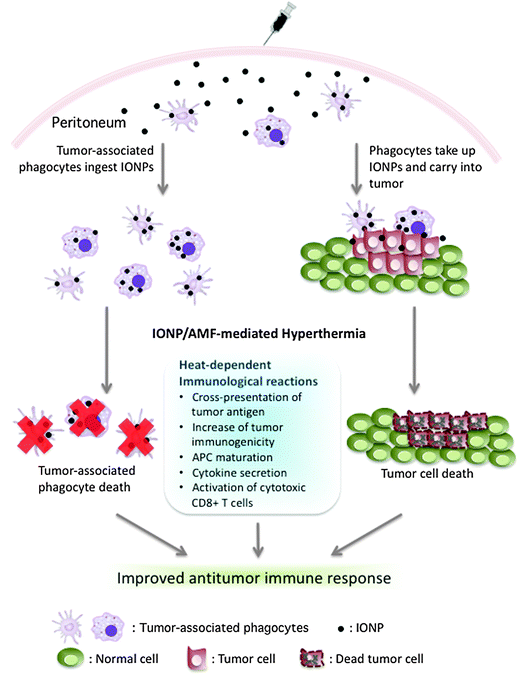 Overview of the therapeutic potential of IONP delivery by phagocytes in ovarian cancer. On the left, tumor-associated phagocytes in the peritoneum ingest IONPs and can be eliminated by IONP/AMF-mediated hyperthermia. On the right, phagocytes in the peritoneum take up and carry IONPs specifically to tumor, and IONP/AMF-mediated hyperthermia damages tumor cells. Noted are reported heat-dependent effects on immune responses. The combined effect of direct killing of tumor cells, elimination of tumor-associated immunosuppressive phagocytes, and heat-dependent immunological effects may improve antitumor immunity.