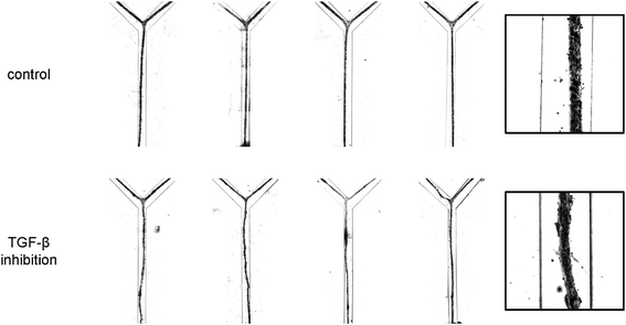 High-contrast bright field micrographs of the morphology of the vascular structures after 24 h of culturing under control conditions and in the presence of inhibitory antibodies. For each condition, four representative examples are given (left). The insets (right) provide a higher magnification view of the structures. Channels are 500 μm wide.