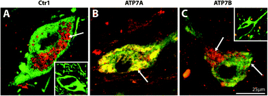 Representative high magnification photomicrographs of the cellular location of Copper transporter 1 (Ctr1), ATP7A, and ATP7B in the human substantia nigra pars compacta. Midbrain sections dual stained for the dopaminergic marker, tyrosine hydroxylase (green), and Ctr1 (A), ATP7A (B), or ATP7B (C) (red). Yellow regions represent co-localisation of TH (green) with Ctr1, ATP7A, or ATP7B (red). Insets: No Ctr1 primary control (A), and no ATP7A and ATP7B primary control (C). Arrows highlight regions of positive staining.