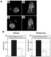 
            In vivo and ex vivo visualization of SPION-labeled MSCs. In vivo MR imaging showed areas of hypointensity in rat muscle tissue in the axial (A; a and c) and sagittal (A; b and d) view albeit with a larger area of hypointensity seen for citrate SPION-labeled MSCs (A; a and b) than for Endorem SPION-labeled cells (A; c and d). Consistently, transplanted citrate SPION-labeled MSCs showed considerably higher hypointense volume and surface area compared to Endorem SPION-labeled cells (B). Reprinted from ref. 69, Copyright (2012) with permission from Elsevier.