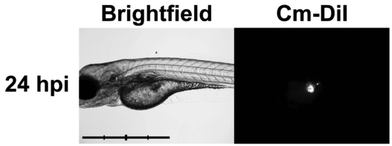 Baseline proliferation (24 hpi) of xenotransplanted K562 leukemia cells in zebrafish embryo. Brightfield (left) and 555 nm fluorescent (right) images of casper zebrafish embryos following successful injection of K562 human leukemia cells at 48 hours of life. Scale bar = 1 mm, intervals = 250 μm. (Abbreviations: hpi = hours post-injection.)