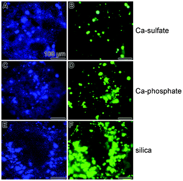 Fluorescent staining of SaOS-2 cells with DRAQ5, for identification of the blue stained cell nuclei (A, C and E), or with the green fluorescent dye (by OsteoImage) to stain specifically hydroxyapatite nodules on the cell surfaces of the SaOS-2 cells (B, D and F). As indicated, the cells were grown onto Ca-sulfate (A̲ and B̲), Ca-phosphate (C̲ and D̲) and silica (E̲ and F̲) grids for 4 d in McCoy's medium/5% FCS and then for 5 d in McCoy's medium/5% FCS, supplemented with mineralization cocktail. After termination of the experiments the specimens were inspected with blue fluorescent light for DRAQ5 and green fluorescence for the OsteoImage dye. All scale bars measure 100 μm.