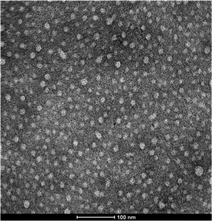 TEM micrograph of a nanogel obtained using 16 wt% of Dex40MA9.