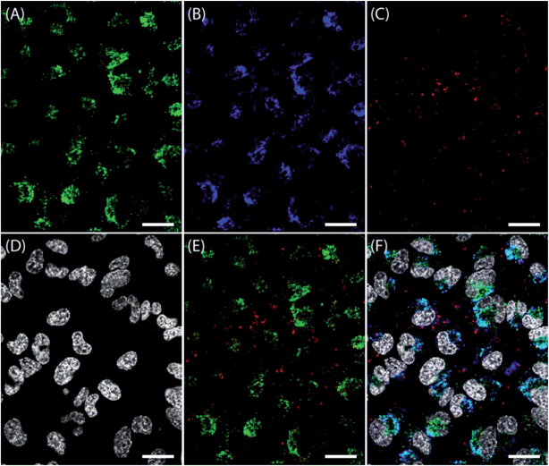 Confocal microscope images of HeLa cells incubated with particles. Cells were seeded at a density of 105 cells per mL for 24 h. The medium was changed and incubated for 30 min. NPs at different sizes and labels (B: medium NPorange; C: large NPred) were added at 50 μg mL−1 simultaneously and incubated for 24 h. (A) LysoTracker Green was added 10 min before microscopic analysis and incubated at 37 °C to stain acidic late endosomes and lysosomes. (D) Cell nuclei were stained with Hoechst 33342. (E) Overlay of stained lysosomes and large NPred. (F) Overlay image of labeled NPs, lysosomes and cell nuclei. The scale bars indicate 20 μm.