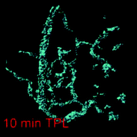 Two-photon 3D reconstructed image of a precancerous (dysplastic) lesion with 10 min post-injection. Modified and reproduced with permission from ref. 158.