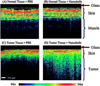 Representative OCT images from normal skin and muscle tissue areas of mice systemically injected with nanoshells (A) or with PBS (B). Representative OCT images from tumors of mice systemically injected with nanoshells (C) or with PBS (D). Analysis of all images shows a significant increase in contrast intensity after nanoshell injection in the tumors of mice treated with nanoshells while no increase in intensity is observed in the normal tissue. The glass of the probe is 200 μm thick and shows as a dark nonscattering layer. Reproduced with permission from ref. 79.