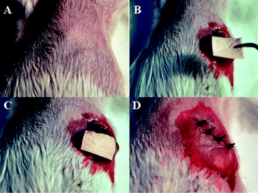 Therapeutic process of nanofibers in the treatment of mice: (A) Anesthetization of mice. (B) Exposure of the liver after laparotomy. (C) Direct placement of drug-loaded nanofibers on the tumor site. (D) Abdominal closure.