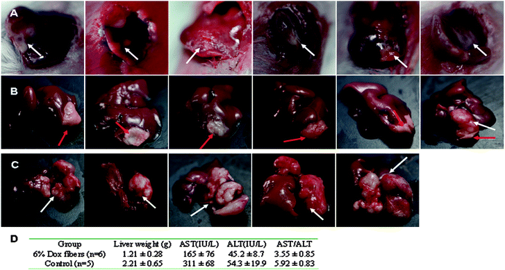 6% Dox fibers inhibited NSHCC in Balb/c mice. Photographs of NSHCC before fiber-mat placement (A), 23 days after 6% Dox fibers placement (B), and 30 days without any treatment (control) (C). The white arrow indicates the site of tumor and the red arrow indicates the site of Dox fiber-mat. (D) Anti-tumor effects of 6% Dox fibers in mice bearing NSHCC.