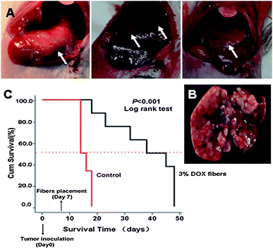 Inhibition of DSHCC in balb/c mice by 3% Dox fibers. (A) Photographs of DSHCC on the 7th day after EMT6 inoculation through portal vein. The white arrow indicates the site of tumor. (B) A liver taken from a dead mouse in control group on the 14th day after tumor inoculation. (C) Survival curves of the mice bearing DSHCC in 3% Dox fibers group (n = 8) and control group (n = 6).